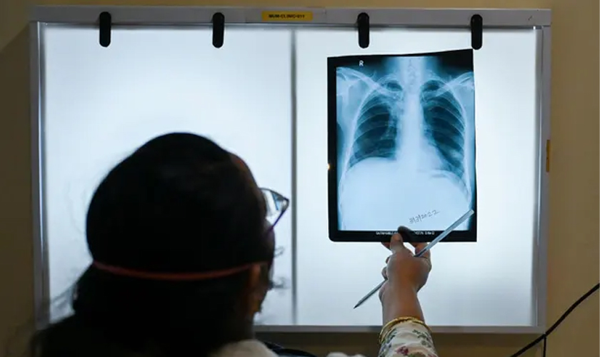 एक सय ५० रुपैयाँमा वडाबाटै एक्स–रे सेवा