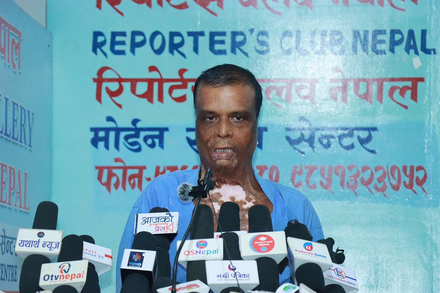 आलमले सफाइ पाएपछि बम लागेका गौरीशङ्कर पीडा सुनाउन काठमाडौँ आए