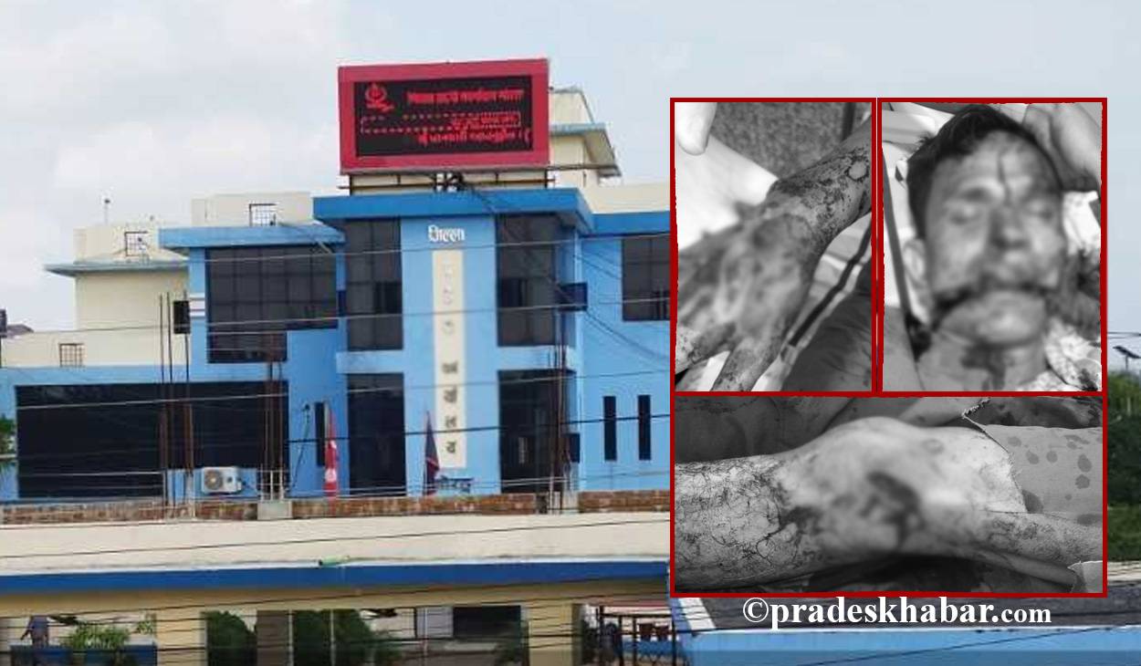 फलोअपः मोरङमा मलेसियाबाट फर्किएका श्रीमानमाथि श्रीमतिले किन प्रहार गरिन् दाउ ?