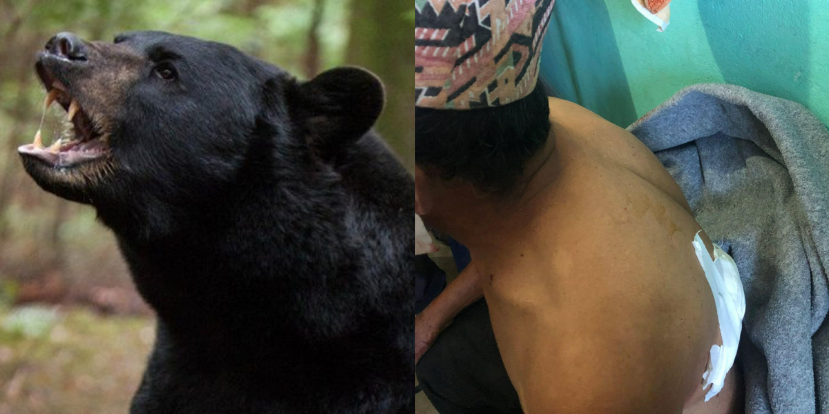 भालुको आक्रमणबाट दुई जना घाइते