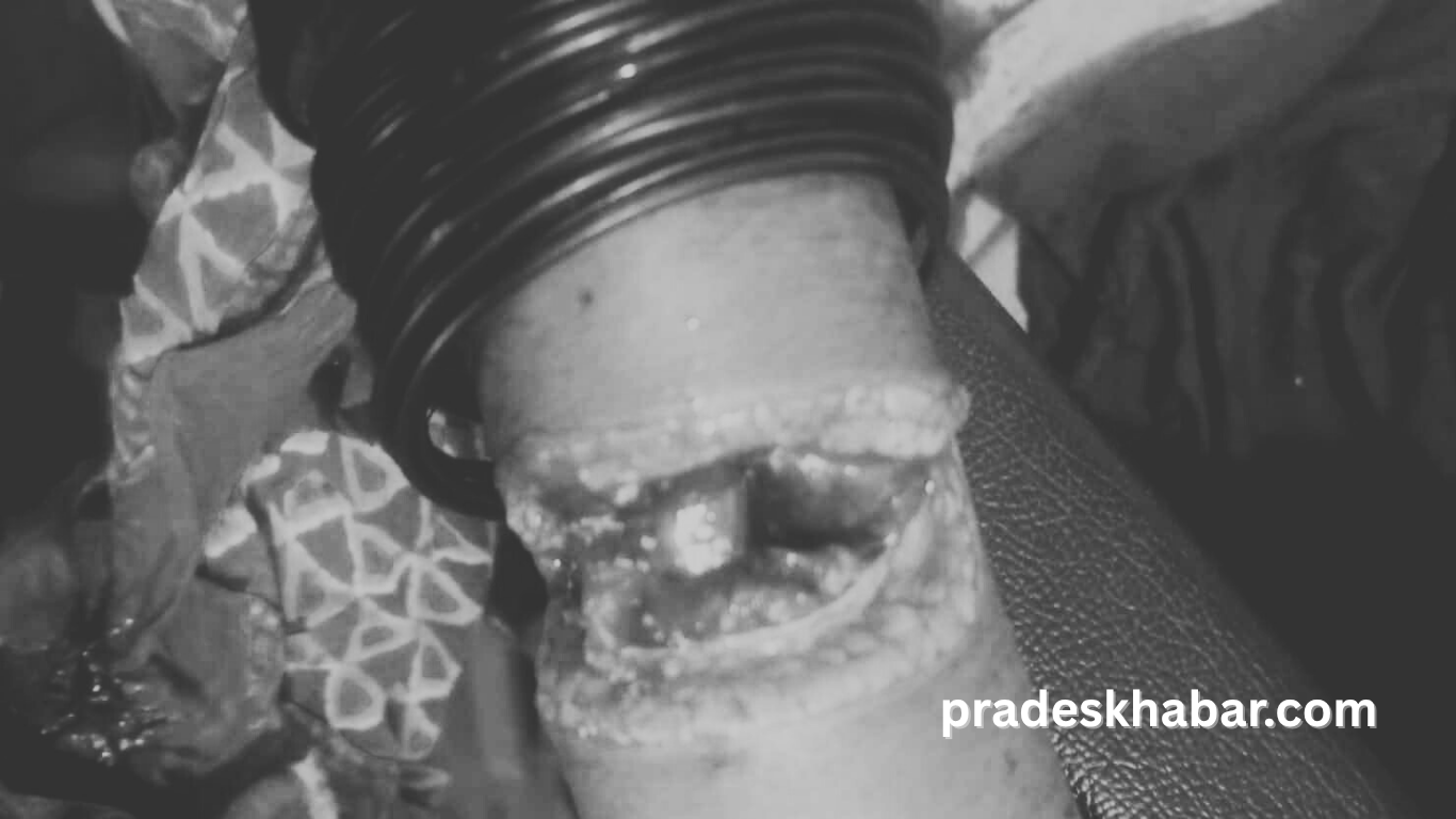 झापामा अज्ञात समूहद्वारा महिलामाथि खुकुरी प्रहार