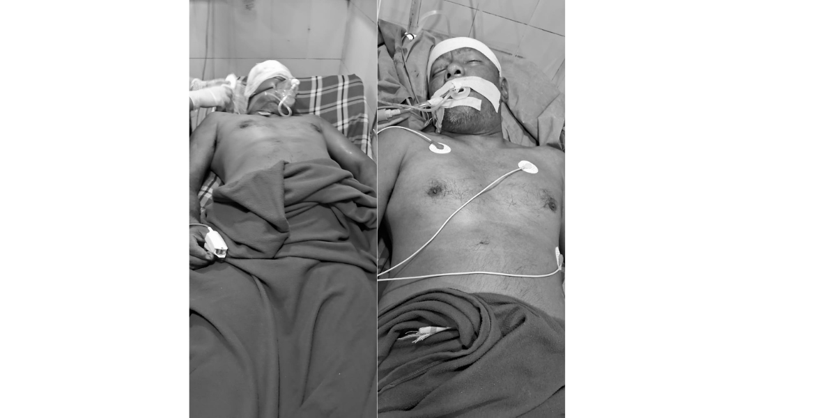 मोरङमा ट्याक्टर चालकले लाट्ठीले हान्दा ट्रक चालक गम्भीर घाइते