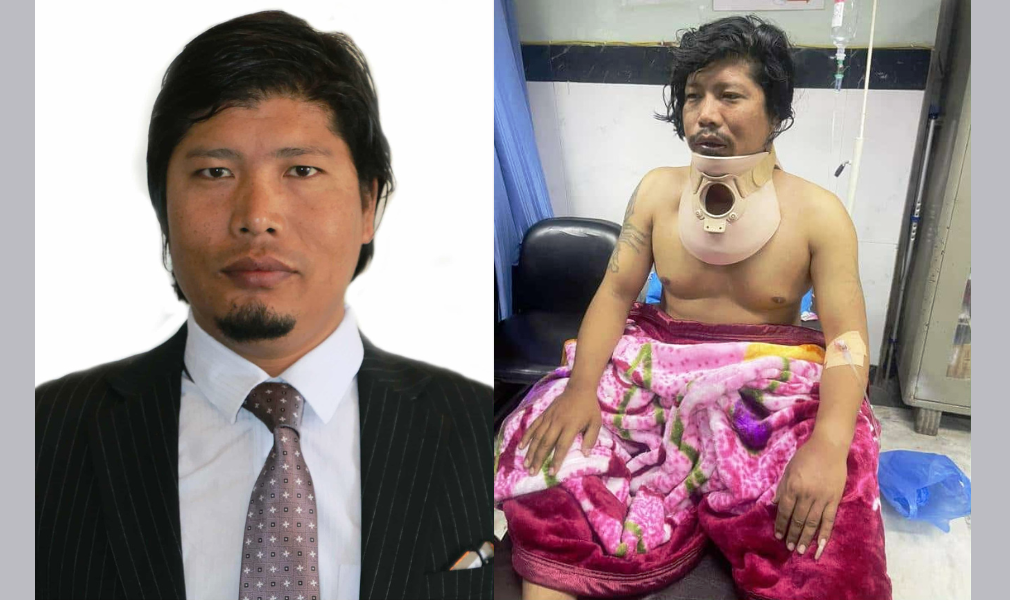 जेन्जी आन्दोलनका घाइते र पीडितहरूको तर्फबाट केसीलाई मन्त्री बनाउन माग