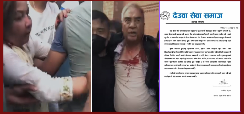 देउवा दम्पती आक्रमणको निन्दा : विरासतबाट नभई झुपडीबाट उठेको नेताका रूपमा चित्रण