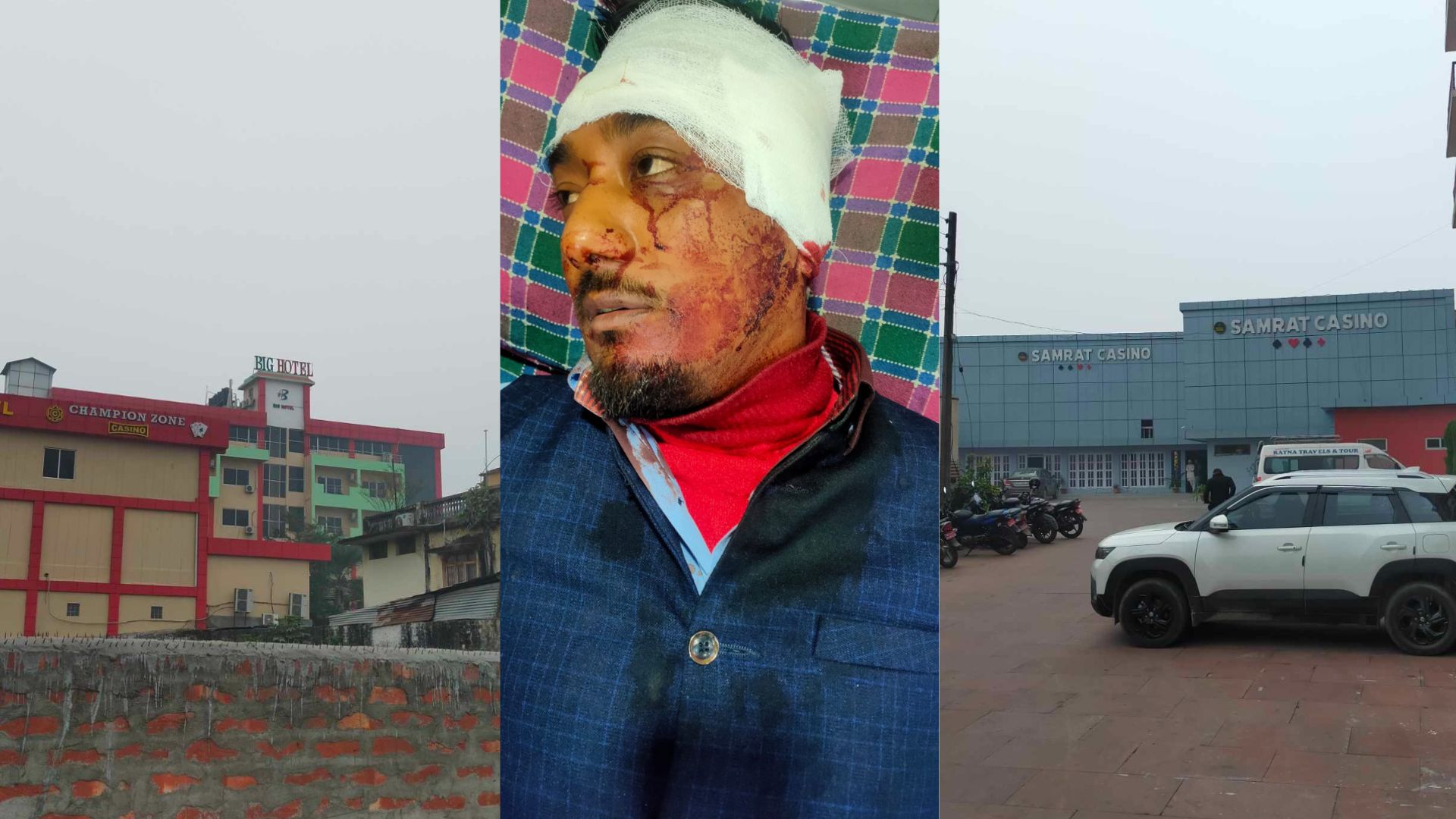 विराटनगरको क्यासिनोमा नेपालीलाई खुलेआम प्रवेश, झगडा हुँदा एक जना युवक घाइते