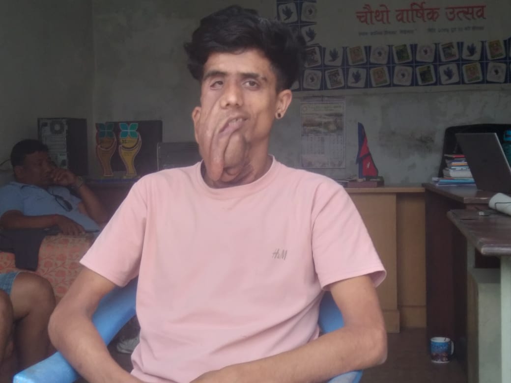व्यस्त तर अस्वस्थ्य झापाका पत्रकार भट्टराईलाई उपचारको चिन्ता