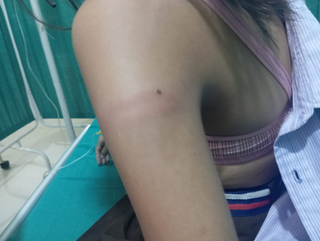 मोरङमा शिक्षकको कुटाइबाट एक विद्यार्थी घाइते, शिक्षक पक्राउ