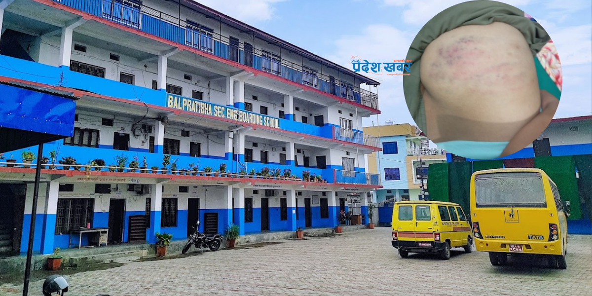 मोरङको सुन्दरहरैँचामा मरणासन्न हुनेगरी शिक्षकले कुटे विद्यार्थी, दबाबमा मिलाइयो घटना
