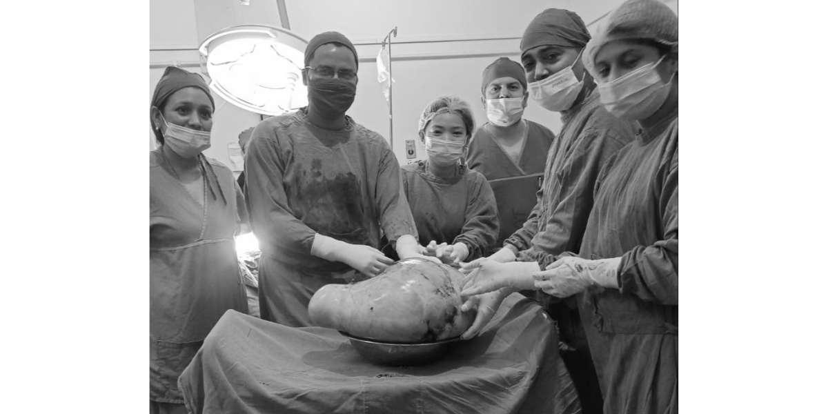 वीपी प्रतिष्ठानमा १८ किलोको ट्युमरको सफल शल्यक्रिया